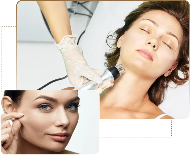 skin tightening treatment in Dubai