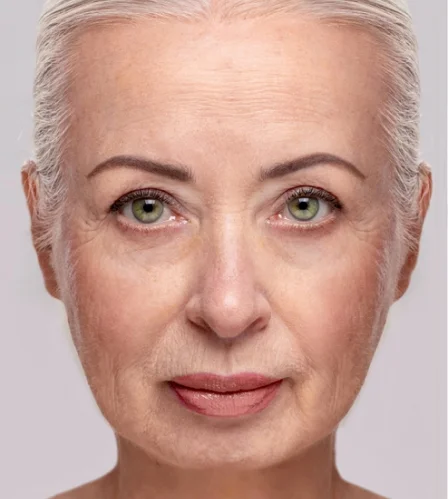Skin tightening treatment Dubai Skin tightening treatment Dubai