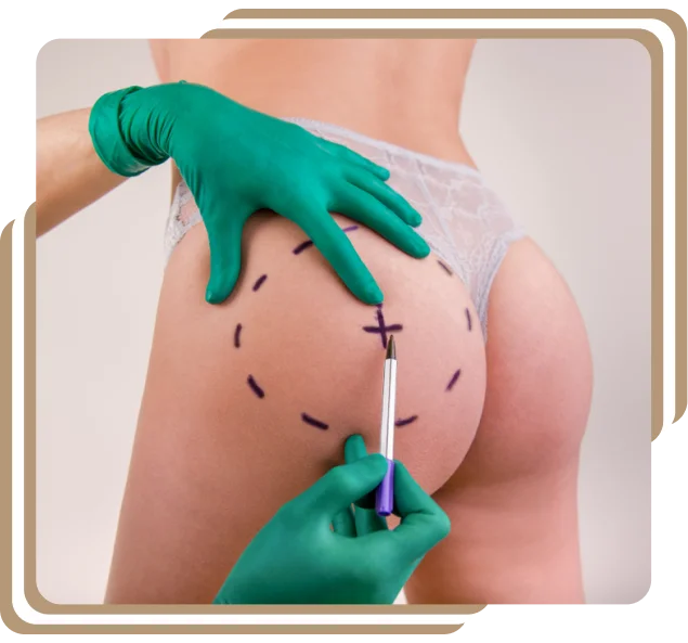 Buttock Augmentation Surgery Dubai