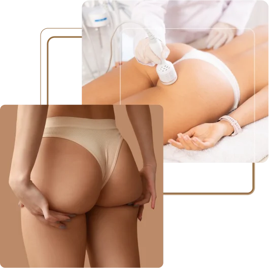 Buttock Augmentation in Dubai