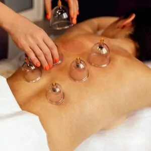 How Often Should You Do Hijama?