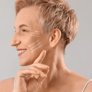 Difference between sculptra and profhilo