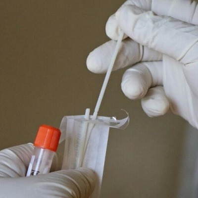 Are there any risks involved with DNA testing?