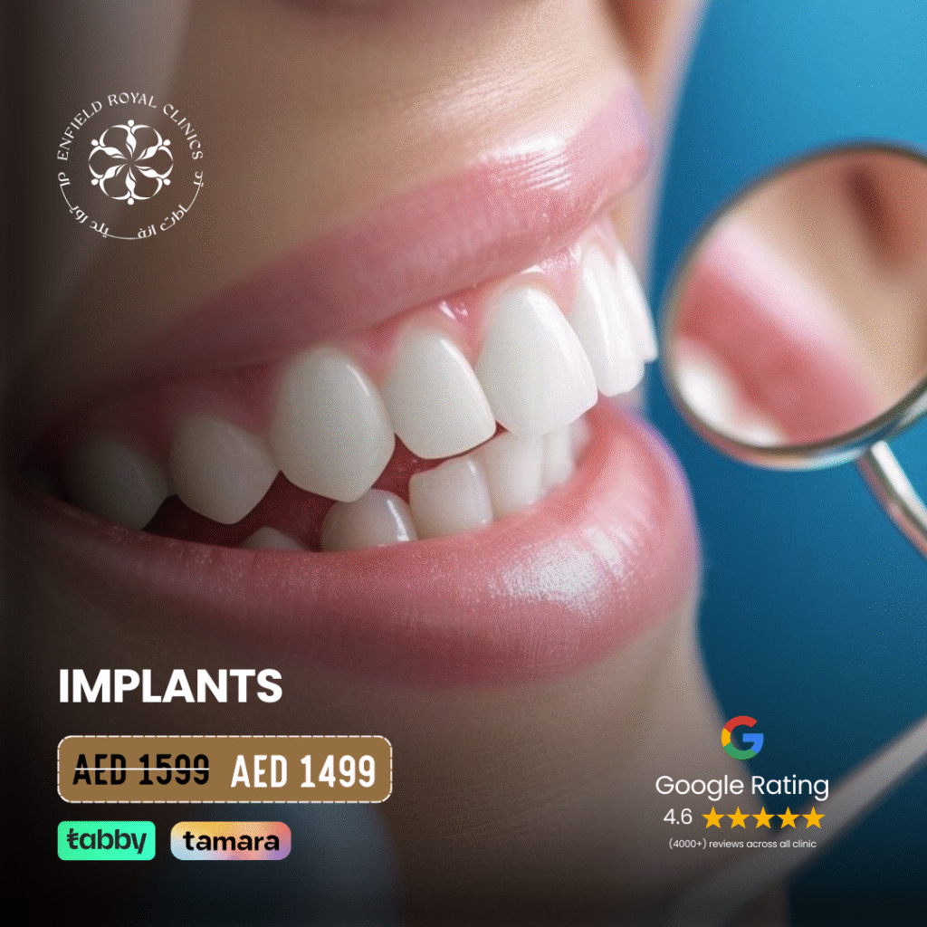 Dental Implant offer