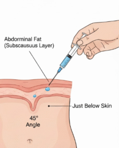 can b12 injection be given subcutaneous Best Vitamin B12 Injection Sites: Where to Inject B12 · PA Relief main image 1