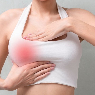 Breast Cysts Treatment in Dubai