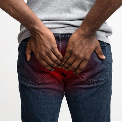 Hemorrhoid Treatment in Dubai