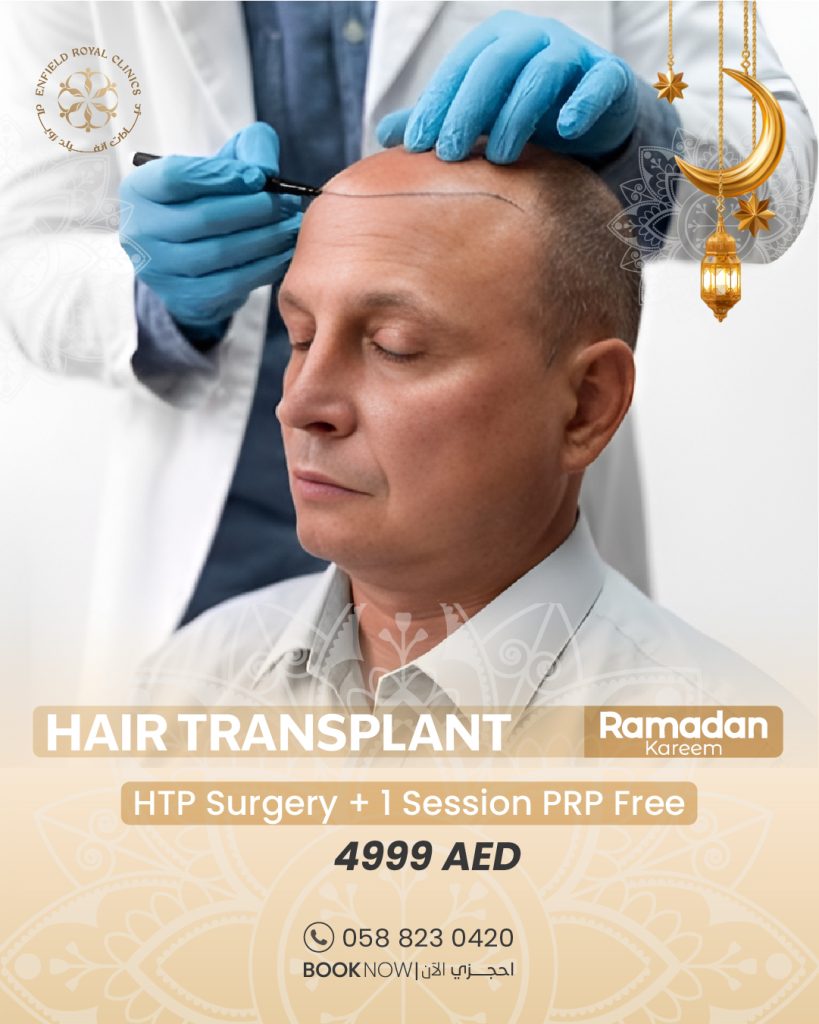 HAIR TRANSPLANT 100