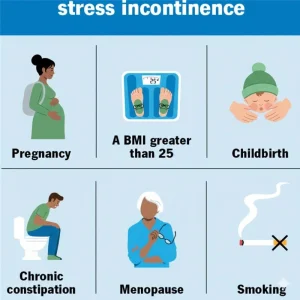 Causes or Risk Factors Stress Urinary Incontinence Causes or Risk Factors Stress Urinary Incontinence