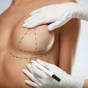 Cost Of Breast Augmentation in Dubai