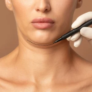 How to get Rid of a Double Chin