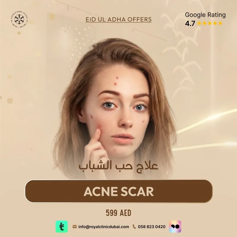 Acne Scar Treatment Eid ul Adha Special Offer 2026 Acne Scar Treatment Eid ul Adha Special Offer 2026