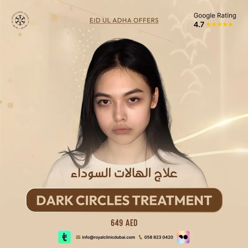 Dark Circles Treatment Eid ul Adha Offer 2026 Dubai Dark Circles Treatment Eid ul Adha Offer 2026 Dubai