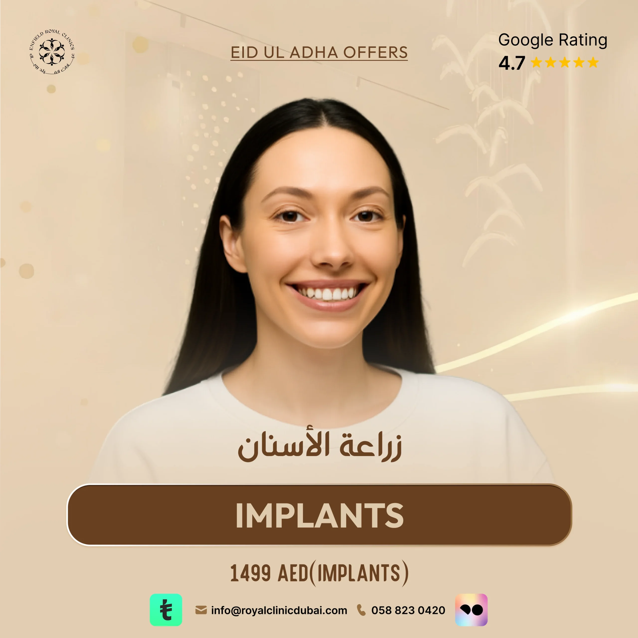 IMPLANTS