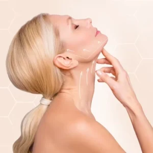 Nefertiti Lift Transforming Neck Aesthetics with Injections