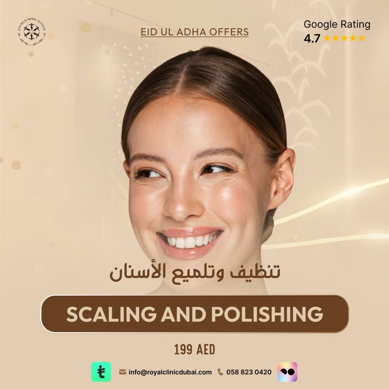 Scaling and Polishing Eid ul Adha Offer 2026 Dubai Scaling and Polishing Eid ul Adha Offer 2026 Dubai