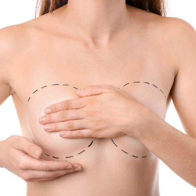 Breast Reconstruction Surgery in Dubai