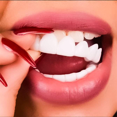 Snap On Smile Dubai
