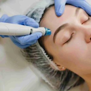 Xela Rederm Face Treatment
