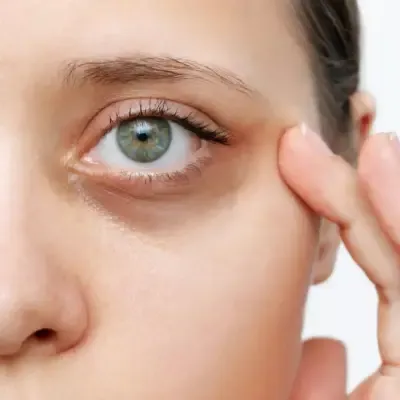 Under Eye Rejuvenation Options for Brighter, Fresher Eyes 1