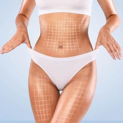 CoolSculpting vs Laser Lipo Which Body Contouring Procedure is Right for You
