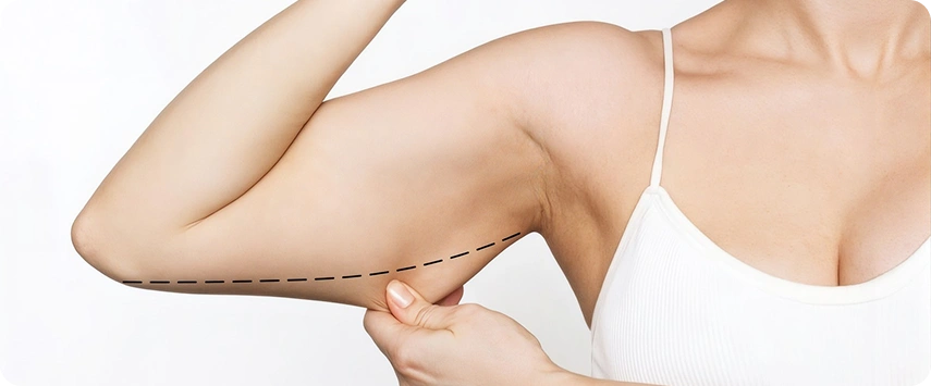 Benefits of Arm Lift Surgery in Dubai