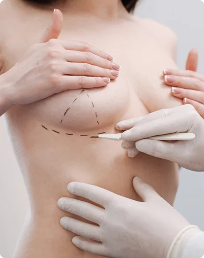 Breast Augmentation