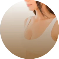 Breast Reduction Surgery (Mammoplasty)