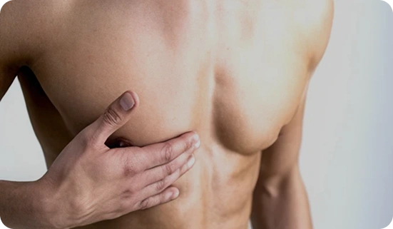 Gland Excision (Subcutaneous Mastectomy)