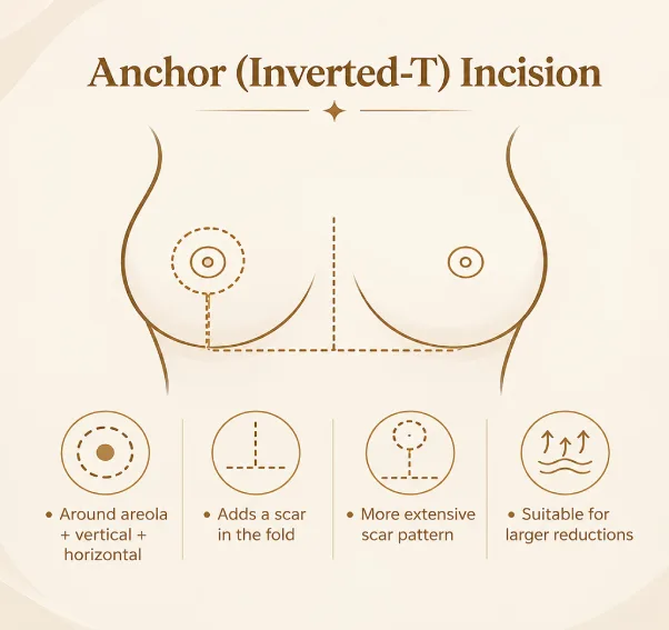 Inverted T (Anchor) Breast Reduction