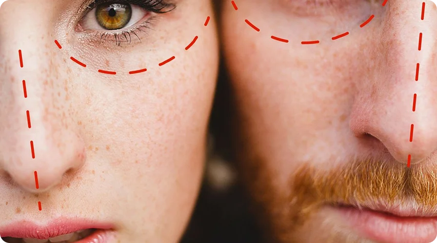 Plastic Surgery Consultation Process
