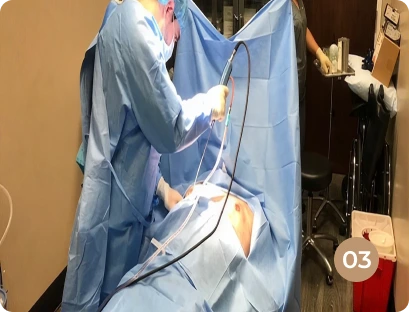 Removal of Excess Tissue in Gynecomastia Surgery