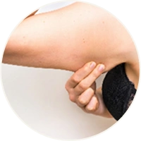 Tissue Tightening for Arm Lift Surgery