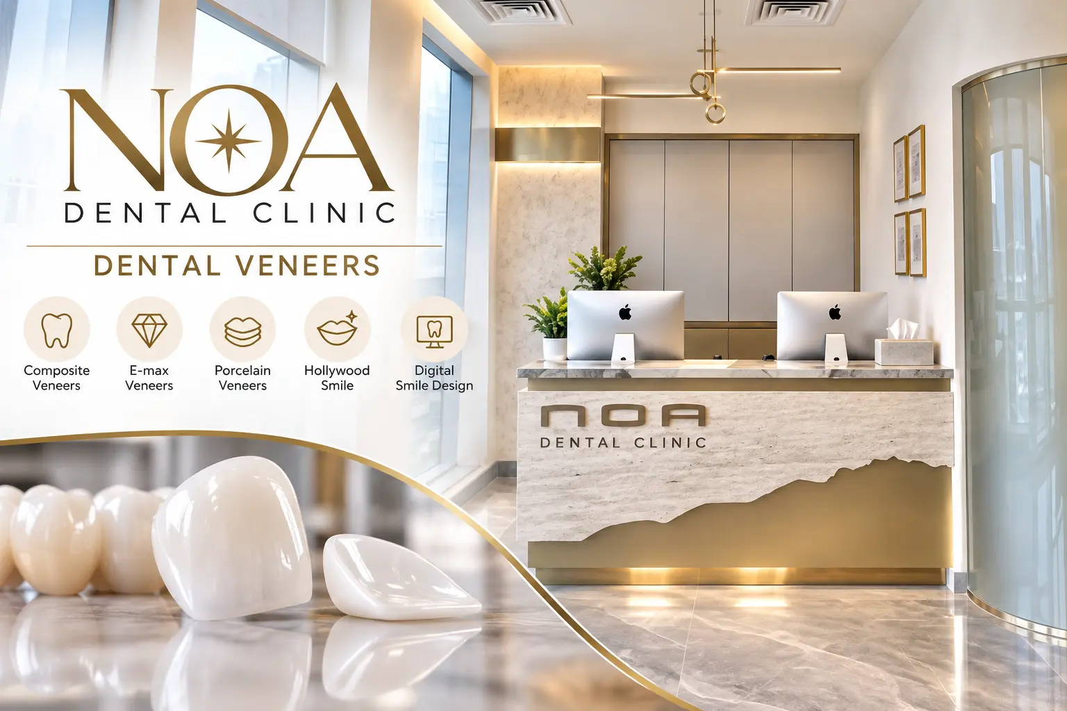 Elegant NOA Dental Veneers Clinic Elegant NOA Dental Veneers Clinic