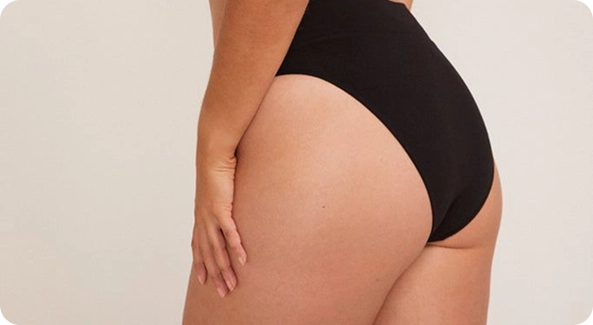 Liposuction for Buttocks