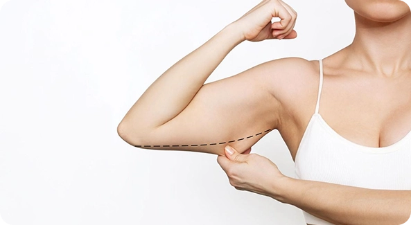 Liposuction for arm