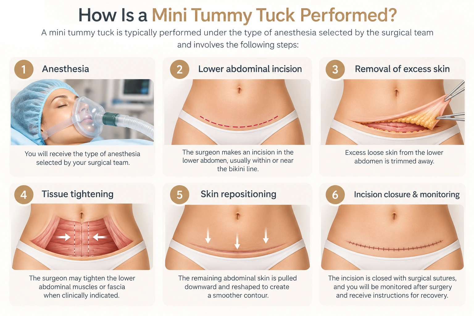 Mini Tummy Tuck Surgery Procedure Mini Tummy Tuck Surgery Procedure