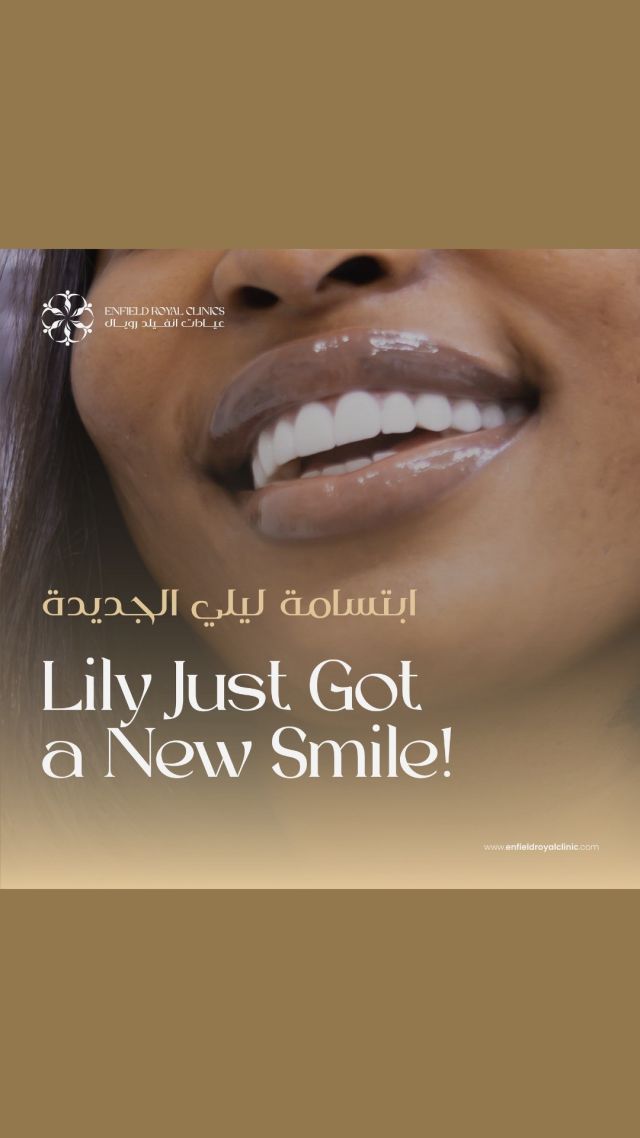✨ Unveil Your Radiant Smile ✨
Introducing the ultimate smile makeover with dental implants! Say goodbye to gaps and hello to a flawless, confident smile! 😁✨✨
ابتسم لتبتسم لك الحياة، وأحصل على أفضل زراعة أسنان تجعل ابتسامتك سحراً لا ينتهي.✨✨😁
#ابتسامة_مشرقة
#أسنان_براقة
#زراعة_الأسنان
.
.
.
☎️ Book now for consultation: +971588230420
📍Dubai