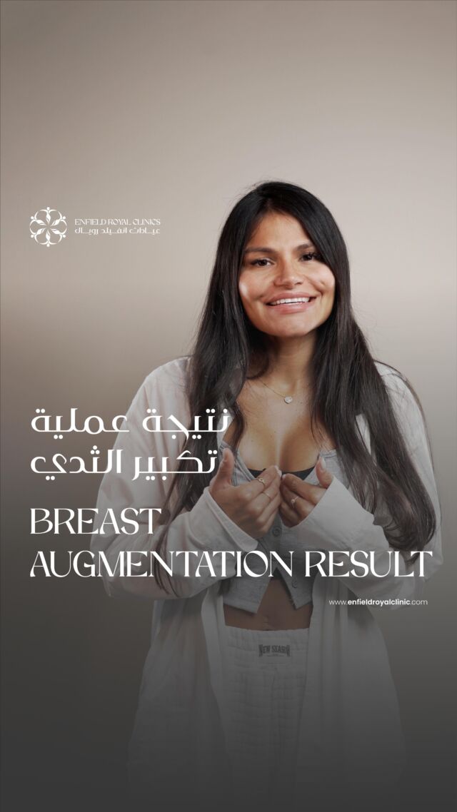 Check out the amazing results, done by our expert plastics surgeon. نتيجة عملية تكبير الثدي الرائعة ، تمت بفضل الطبيب الجراح لدينا . Book your consultation today , and enjoy the wonderful experience. ☎️043739000